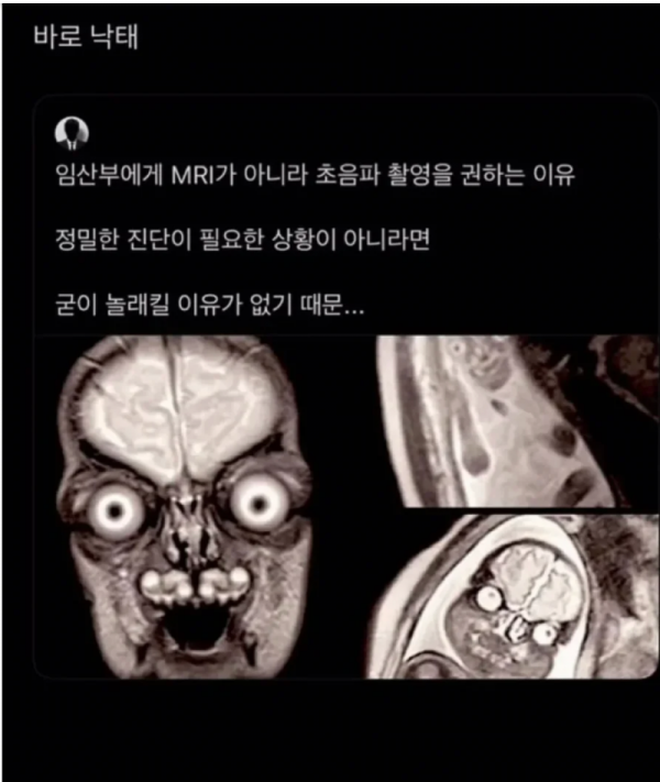 스크린샷 2026-03-17 오후 8.41.54.png