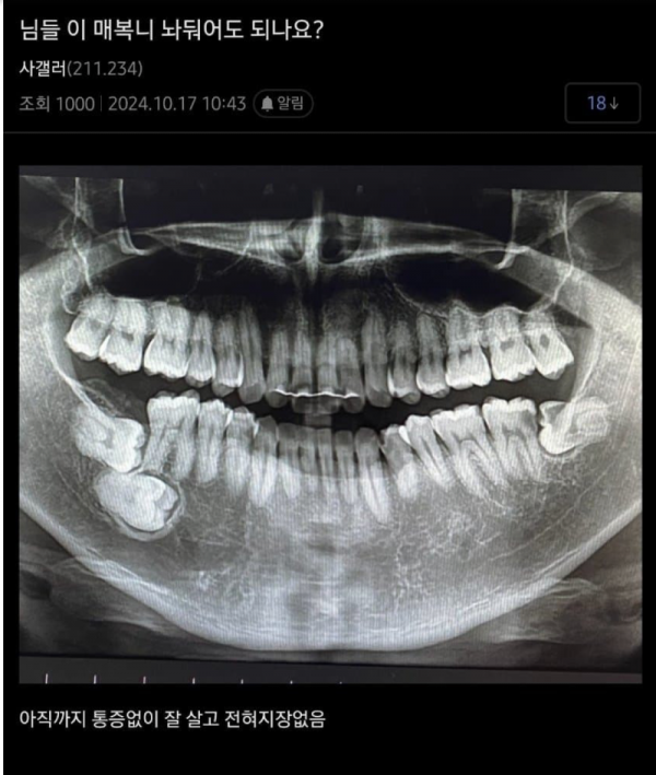 스크린샷 2026-03-24 오후 8.52.57.png